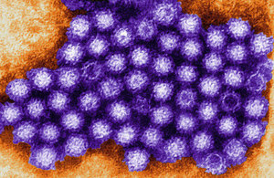 Norovirus: all you need to know to prepare